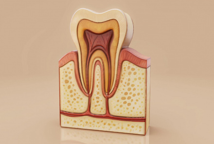 Гранулёма зуба