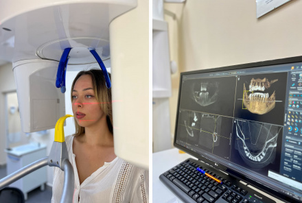 Рентген зуба в Красноярске