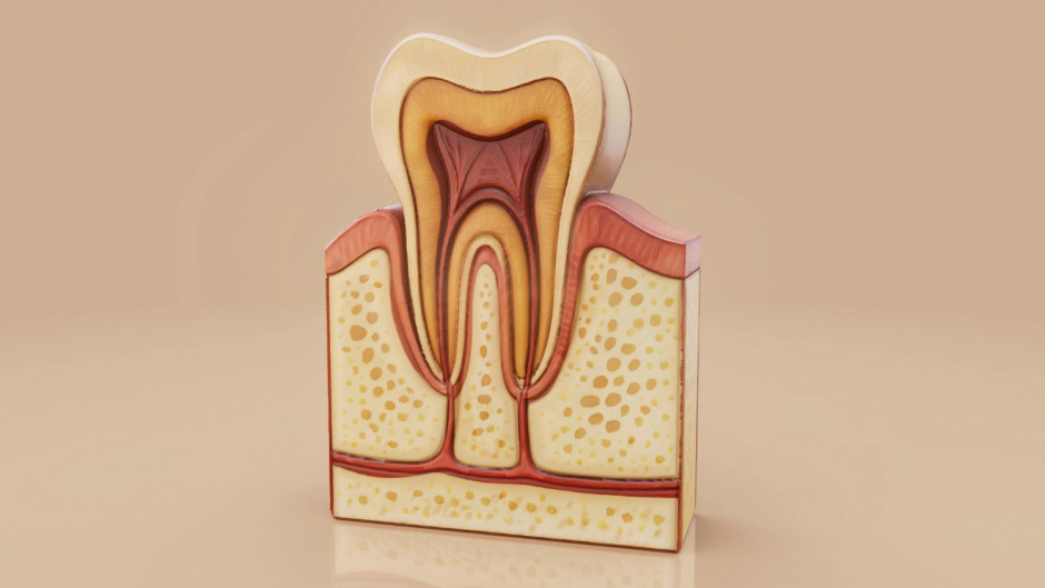 Гранулёма зуба