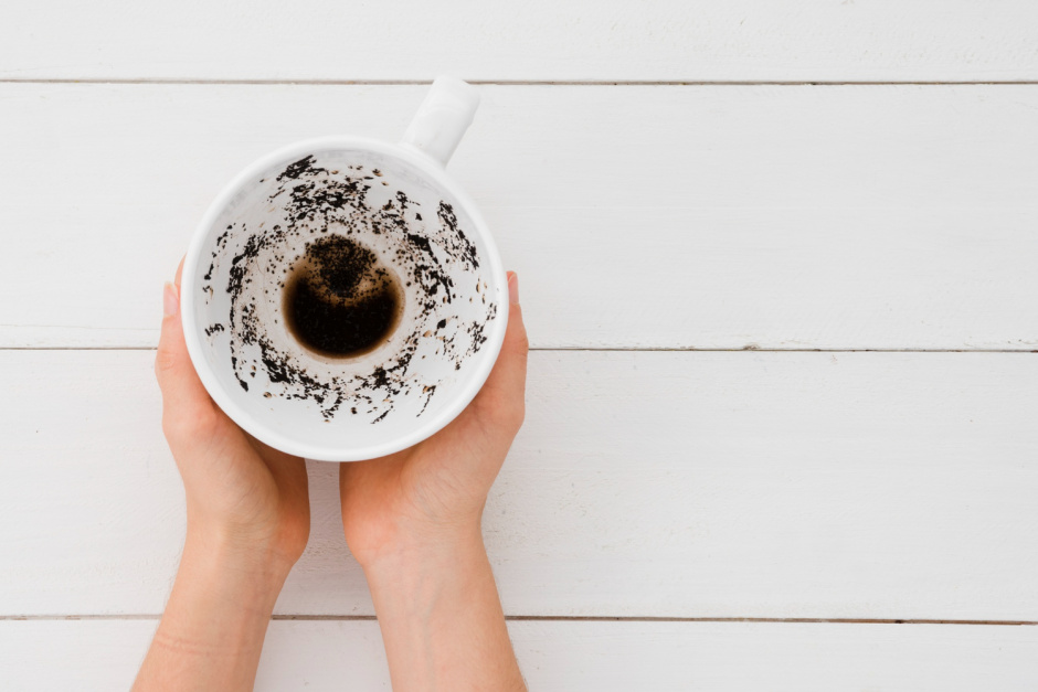 Пигментация зубов